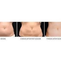 Портфолио Evolution MedSpa Boston